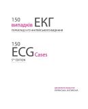 150 випадків ЕКГ=150 ECG Cases: пер. 5-го англ. вид.: Навч. посіб.. Зображення №4