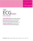 150 випадків ЕКГ=150 ECG Cases: пер. 5-го англ. вид.: Навч. посіб.. Зображення №5